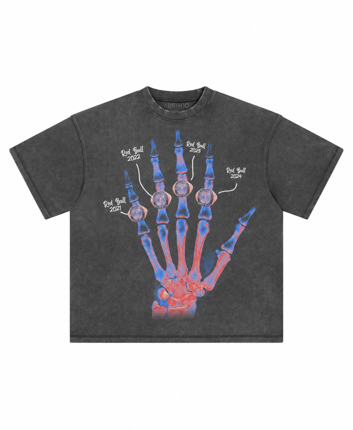 MV XRAY TEE