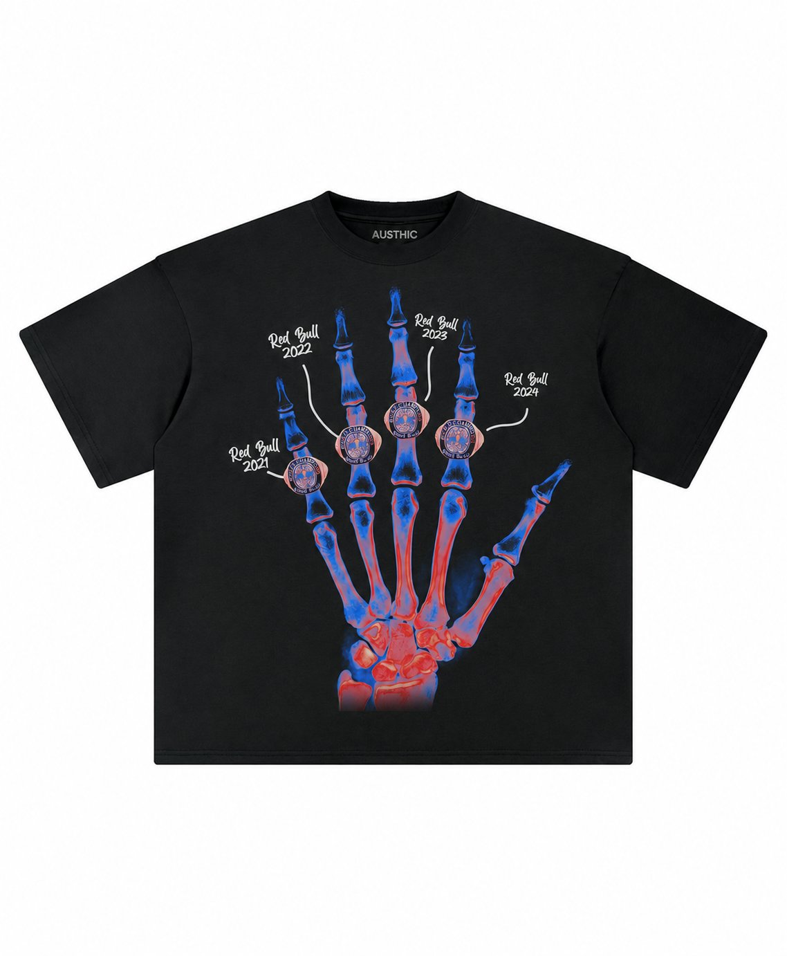 MV XRAY TEE
