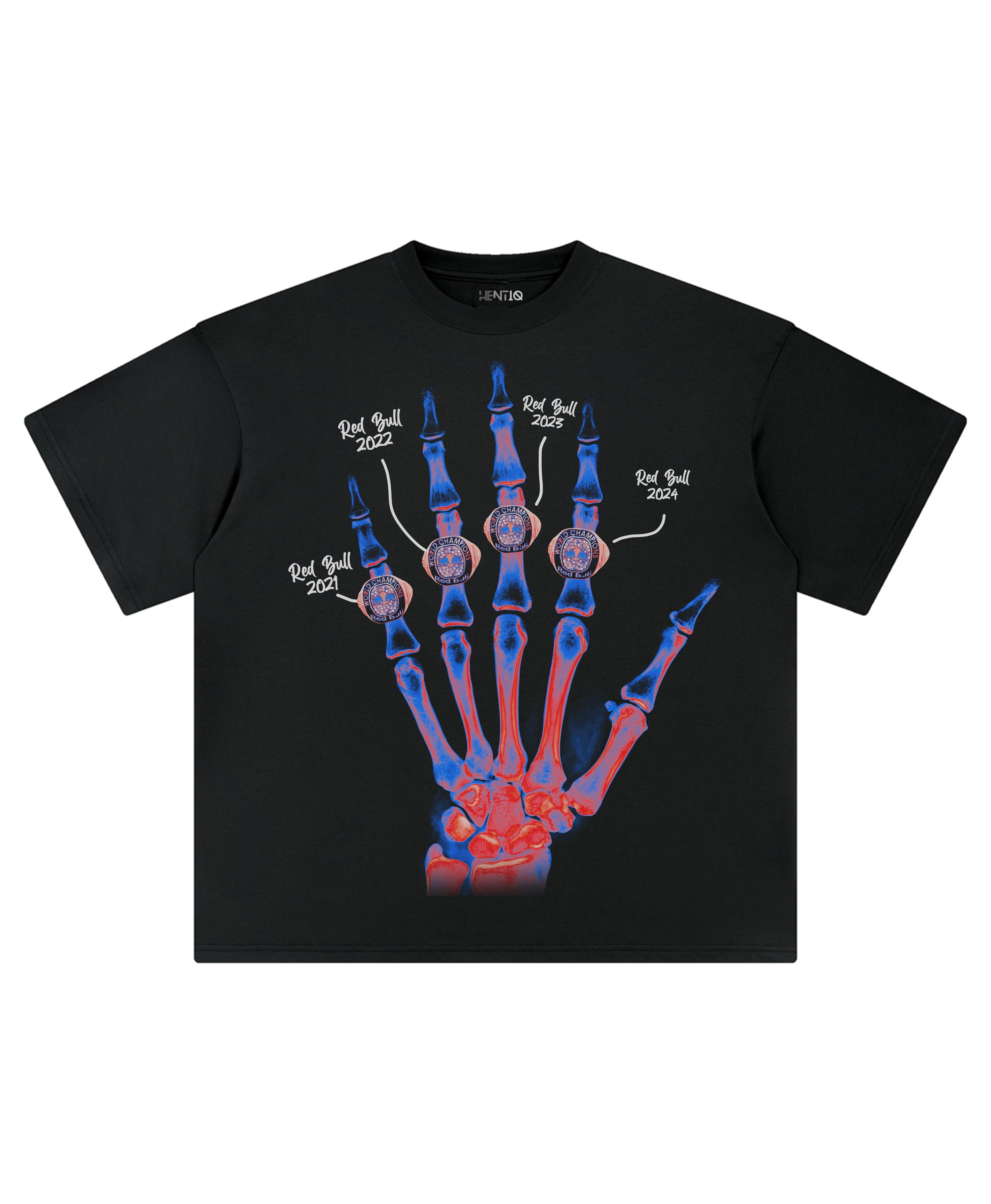 MV XRAY TEE